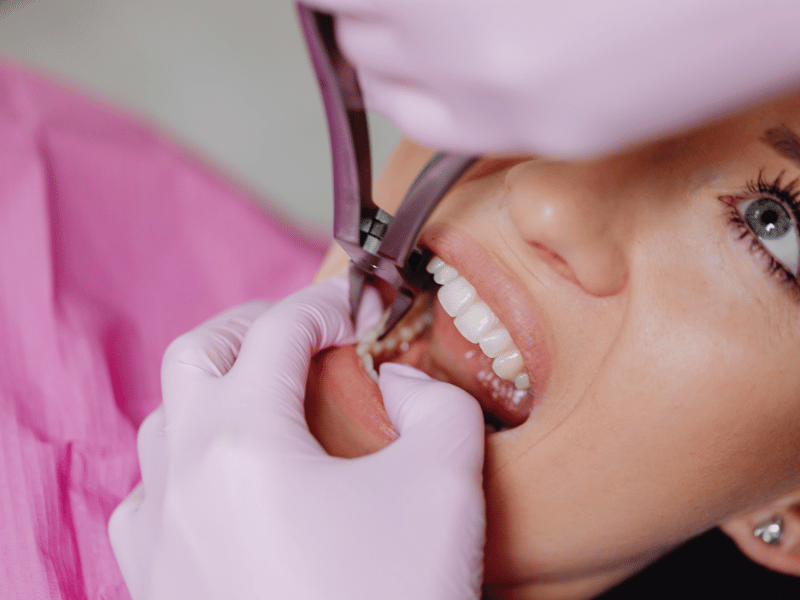 The Process of Dental Implants Near You